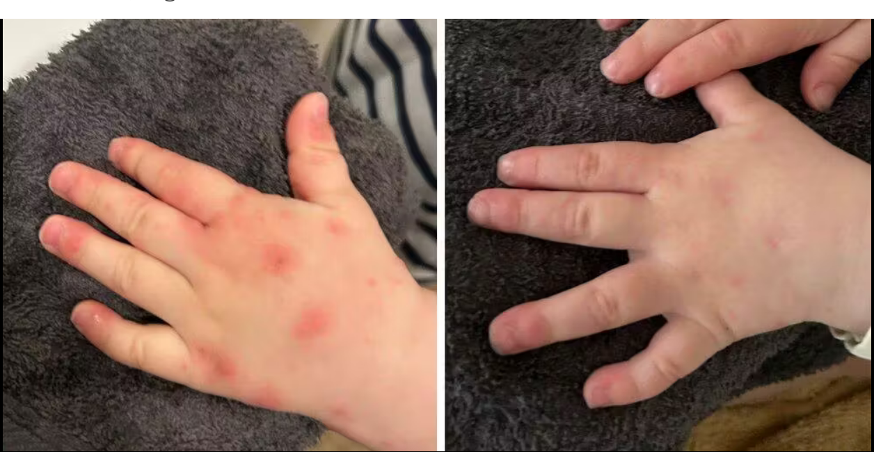 Baume Pissenlit – Peaux à Problèmes & Inflammations