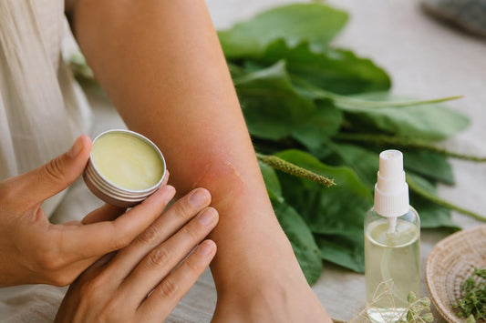 Main appliquant un baume apaisant sur une peau irritée, avec un spray anti-moustiques à proximité, ambiance naturelle et végétale.